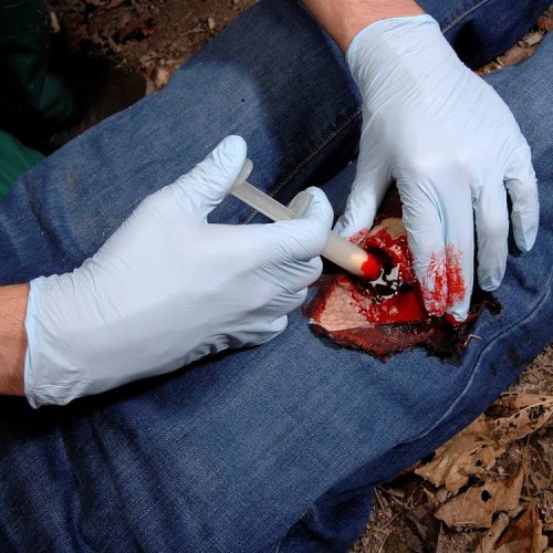 Аппликатор гемостатический с гранулами Rhino Rescue в Энгельсе хитозановый